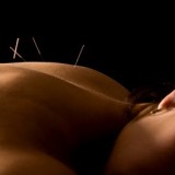 Acupuncture – Know and benefit from it
